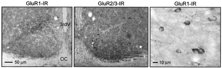 FIG. 6