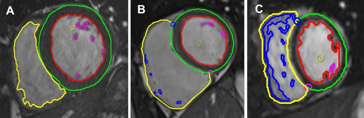 Fig. 4