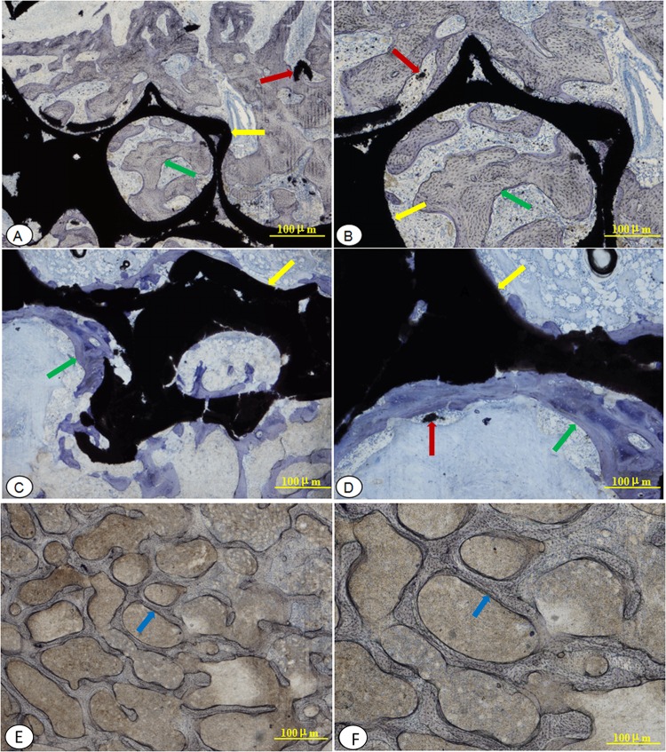 Fig 13