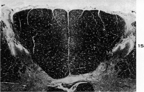 Fig. 15