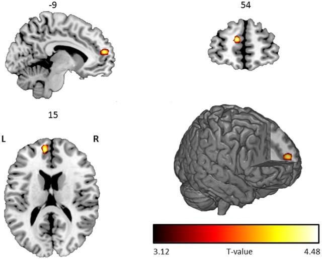 Fig. 2.