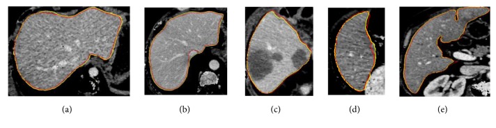 Figure 11