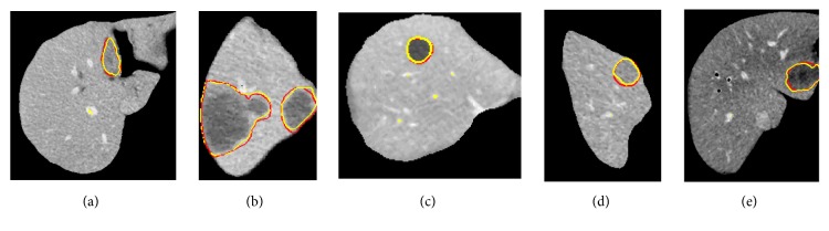 Figure 12