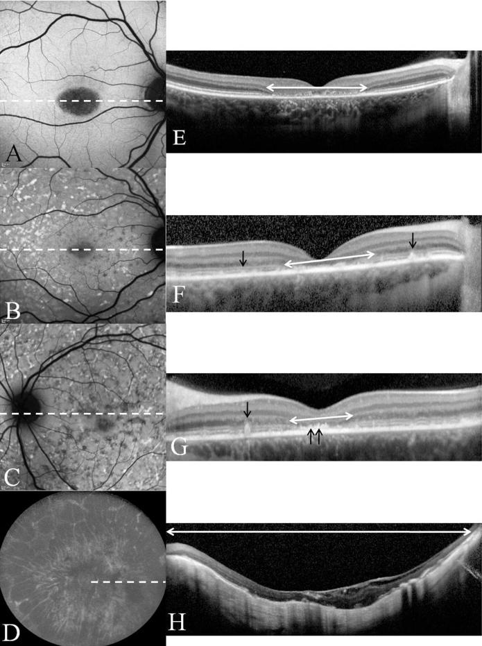 FIG. 4