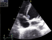 Fig 2.