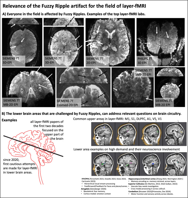 Fig 2: