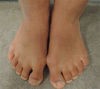 Figure 2a