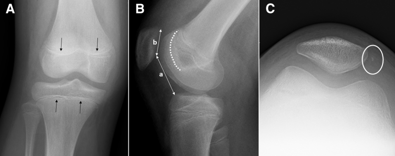 Fig 1