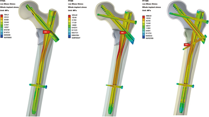 FIGURE 4