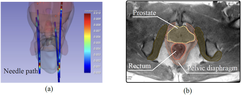 FIG. 2: