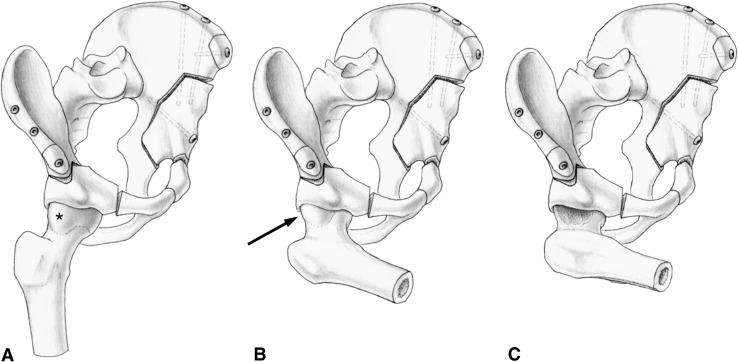 Fig. 1A–C