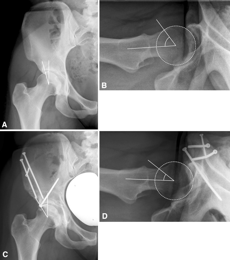 Fig. 4A–D