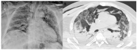 Figure 2.