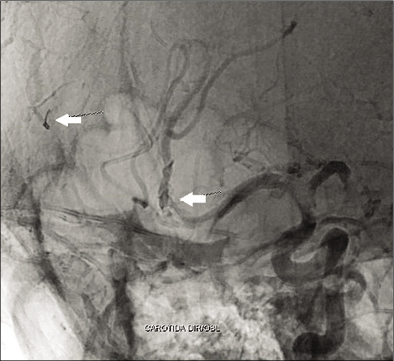 Figure 2: