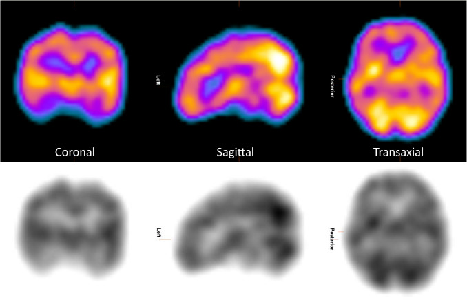 Fig. 2