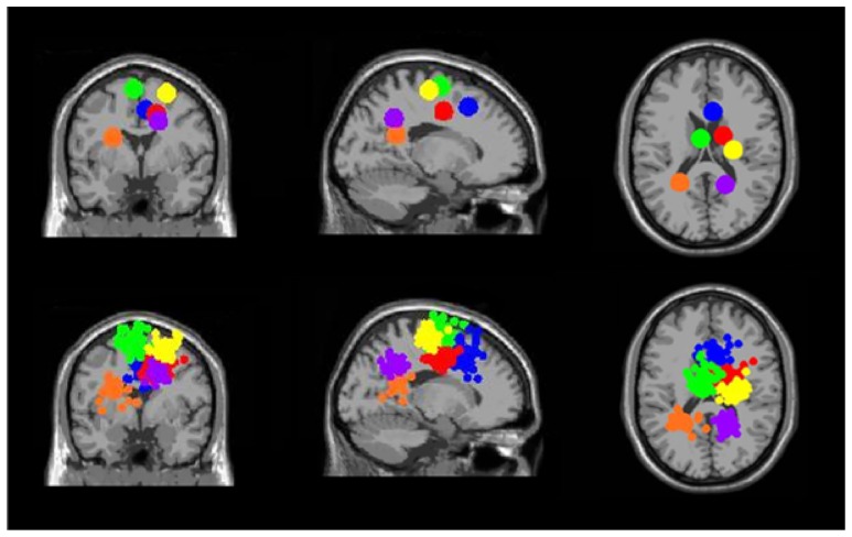 FIGURE 11