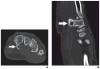 Fig. 10