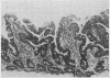 79