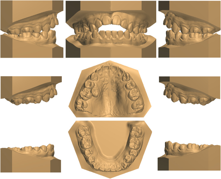 Fig. 2
