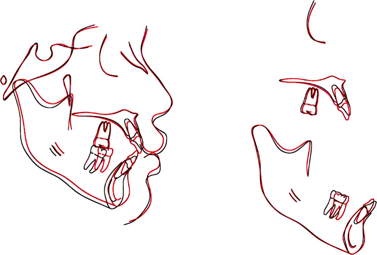 Fig. 11