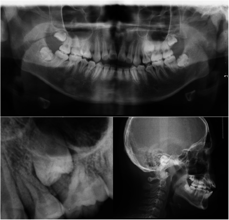Fig. 3