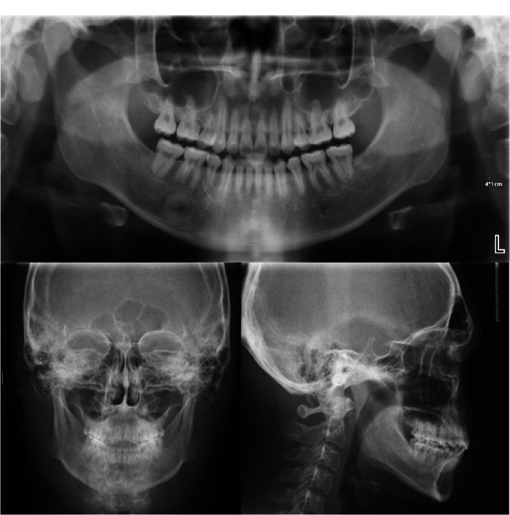 Fig. 10
