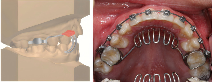 Fig. 4