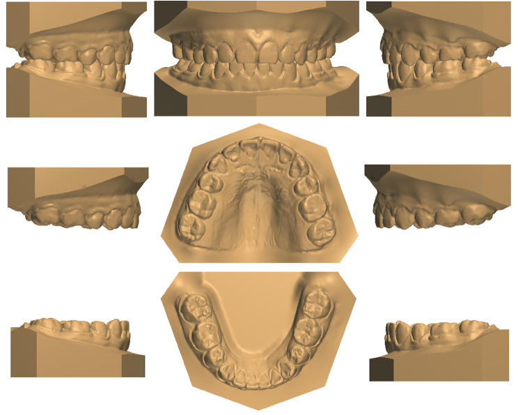 Fig. 9