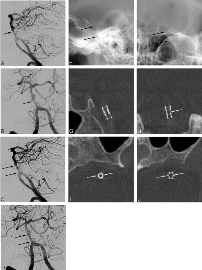 Fig 3.