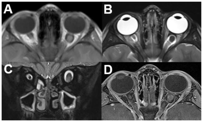 Figure 16