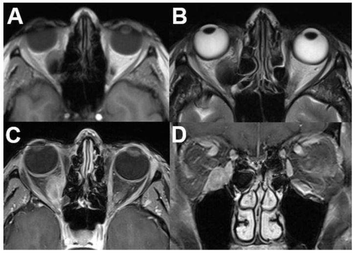 Figure 24