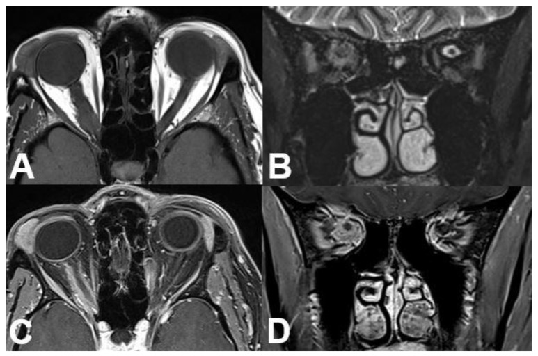 Figure 18