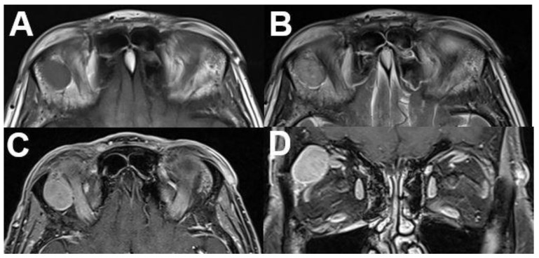 Figure 22