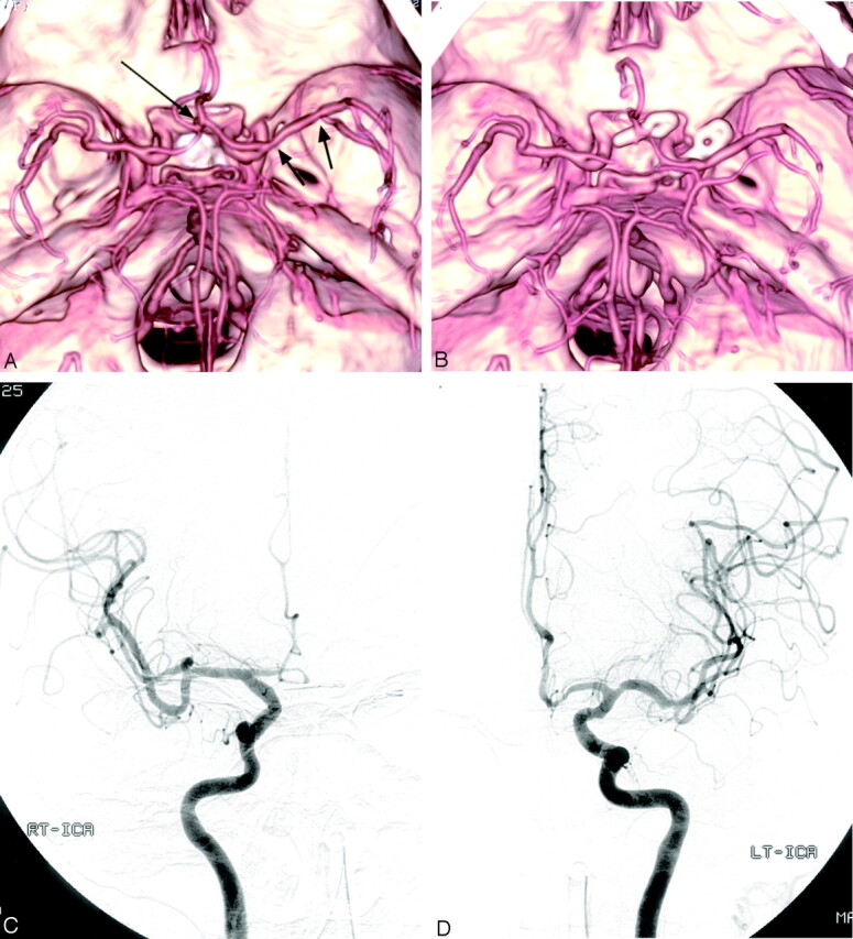 Fig 1.