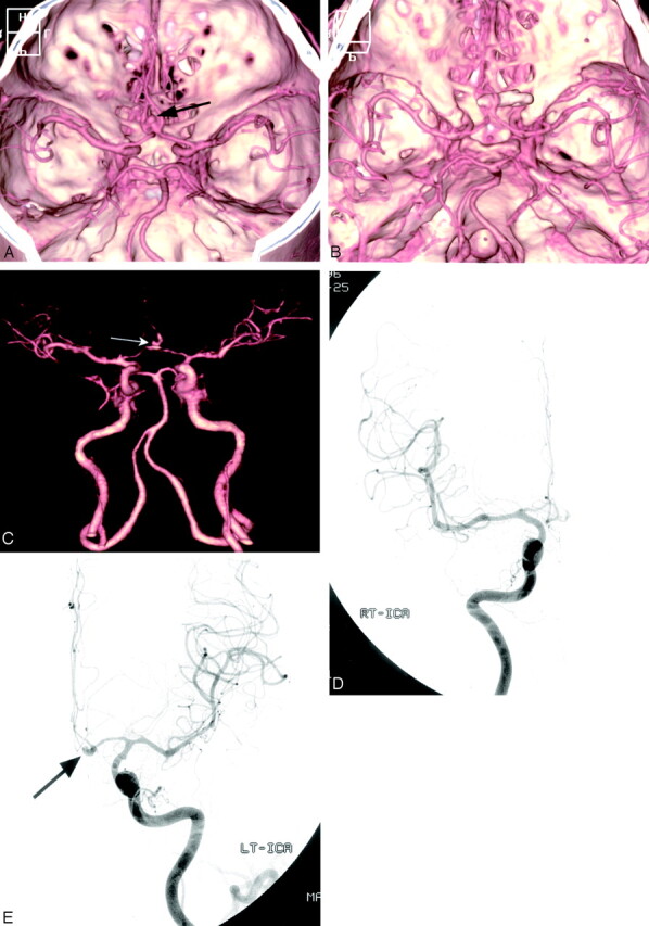 Fig 2.