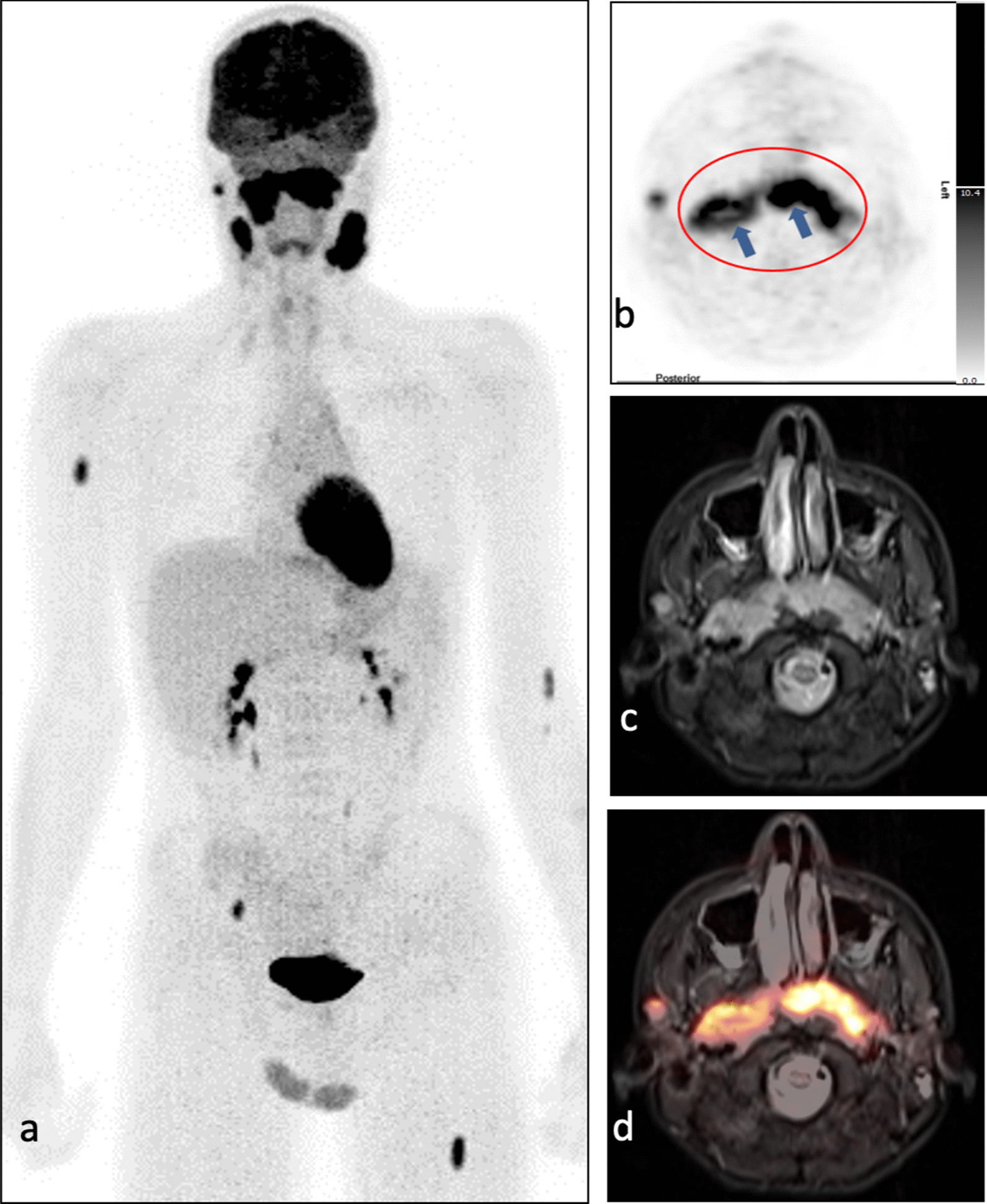 Fig. 4