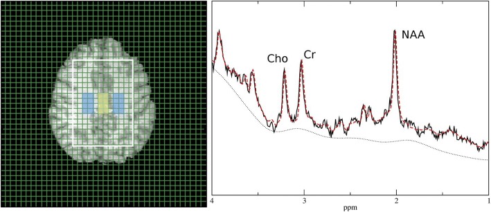 Fig. 1