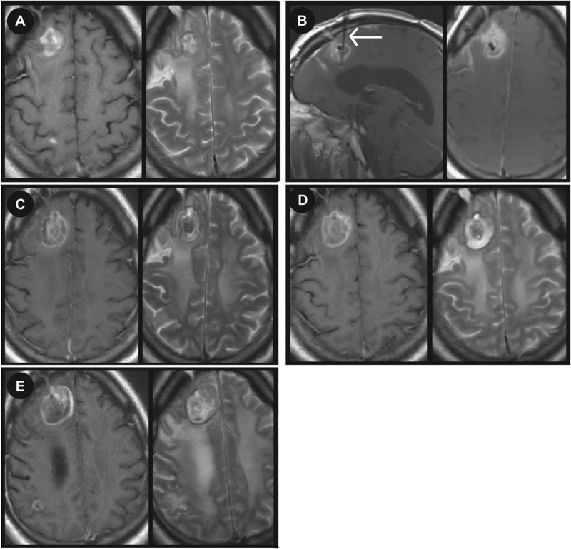 FIGURE 4