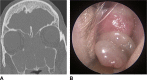 Fig. 18.4