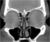 Fig. 18.3