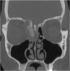Fig. 18.2