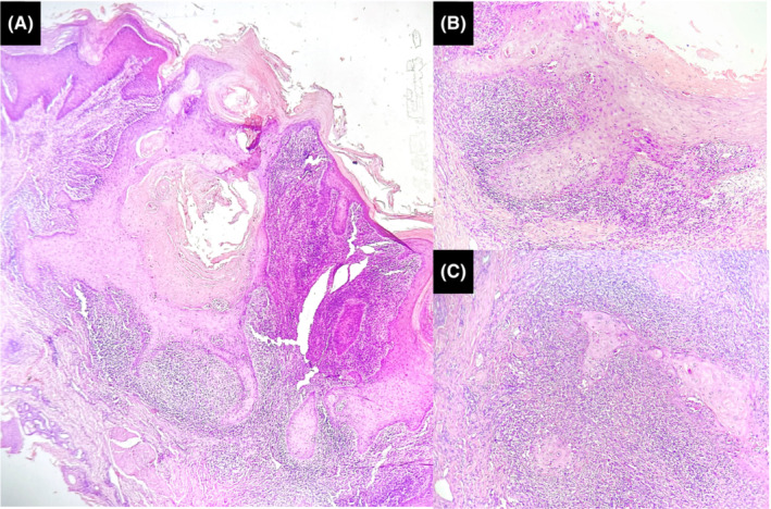 FIGURE 2