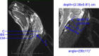 Fig. 3