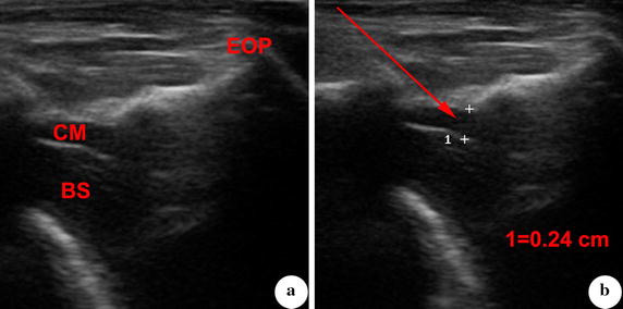 Fig. 2