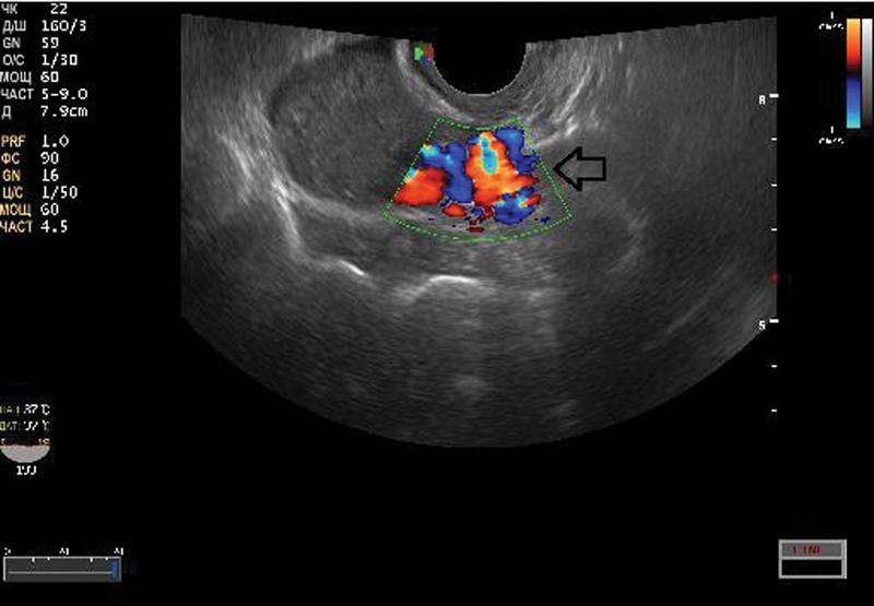 Fig. 2