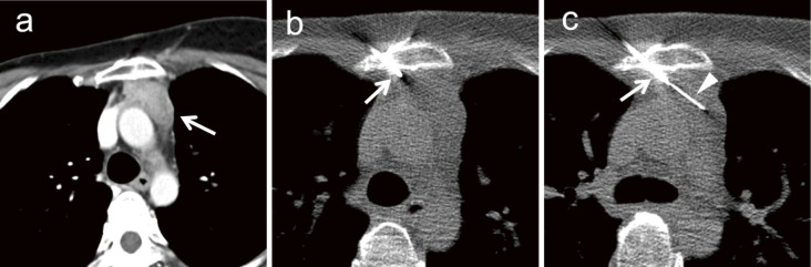 Fig. 6.