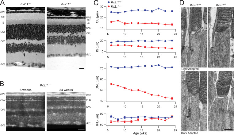 Figure 11.