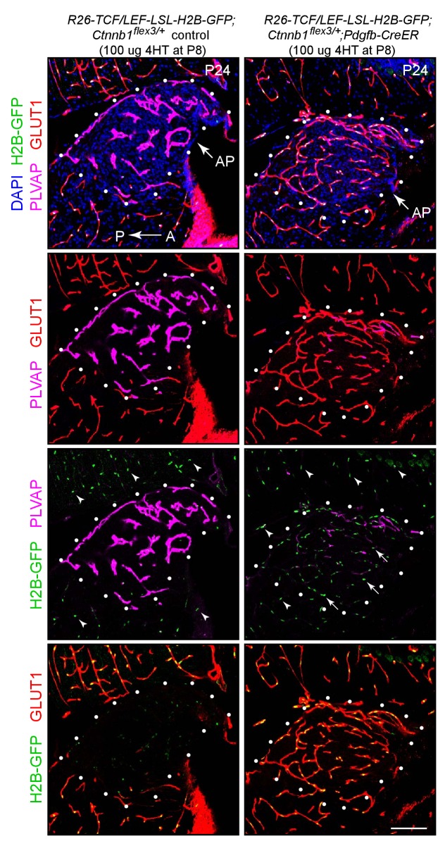 Figure 2—figure supplement 3.