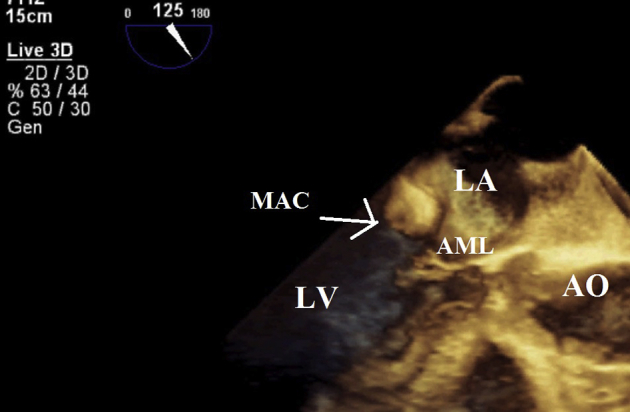 Figure 5