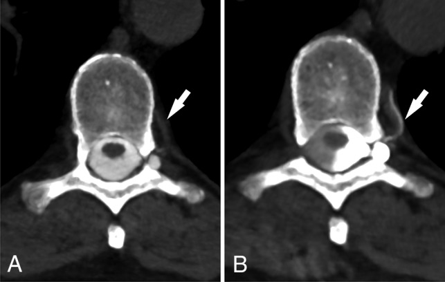 Fig 3.